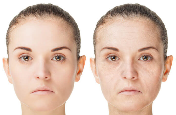 5 Medical Anti Aging Treatment Methods That You Can Try!